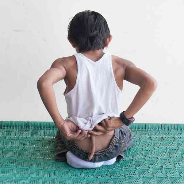 Tại sao một số người sinh ra có đuôi như động vật? - Ảnh 2. Tại sao một số người sinh ra có đuôi như động vật? - Ảnh 2.