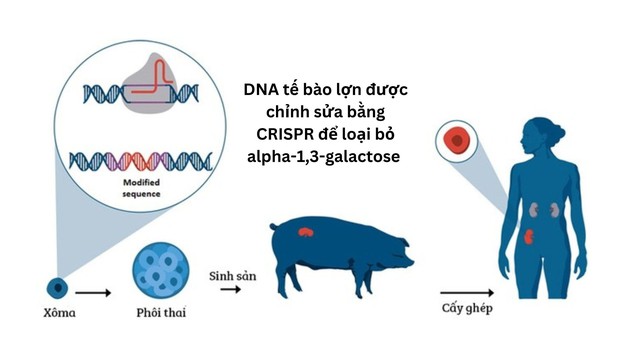 Đột phá: Các bác sĩ Mỹ ghép thận lợn sang người và ước mơ về một nguồn cung nội tạng vô tận - Ảnh 6. Đột phá: Các bác sĩ Mỹ ghép thận lợn sang người và ước mơ về một nguồn cung nội tạng vô tận - Ảnh 6.