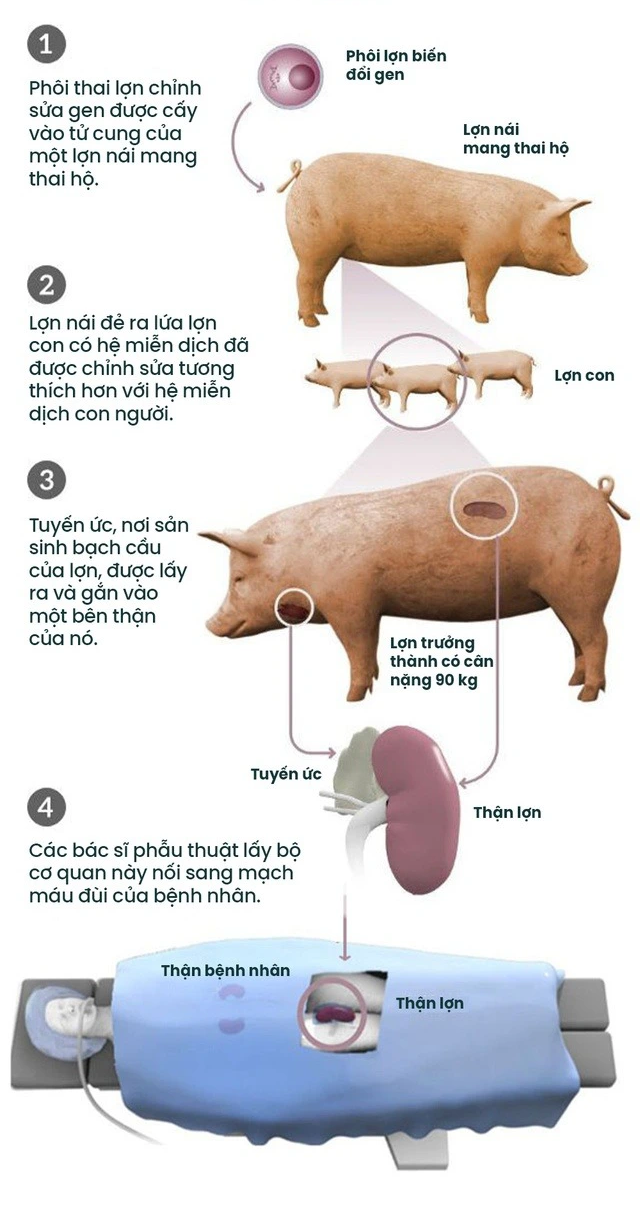 Đột phá: Các bác sĩ Mỹ ghép thận lợn sang người và ước mơ về một nguồn cung nội tạng vô tận - Ảnh 7. Đột phá: Các bác sĩ Mỹ ghép thận lợn sang người và ước mơ về một nguồn cung nội tạng vô tận - Ảnh 7.