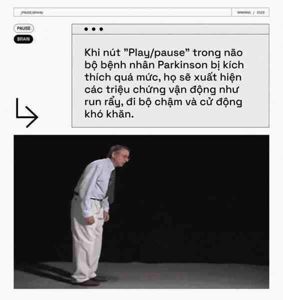 Các nhà khoa học tìm thấy một nút "Pause" trong não bộ, khi nhấn vào, toàn bộ cơ thể bạn sẽ bất động - Ảnh 15. Các nhà khoa học tìm thấy một nút "Pause" trong não bộ, khi nhấn vào, toàn bộ cơ thể bạn sẽ bất động - Ảnh 15.