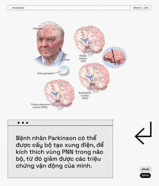 Các nhà khoa học tìm thấy một nút "Pause" trong não bộ, khi nhấn vào, toàn bộ cơ thể bạn sẽ bất động - Ảnh 16. Các nhà khoa học tìm thấy một nút "Pause" trong não bộ, khi nhấn vào, toàn bộ cơ thể bạn sẽ bất động - Ảnh 16.