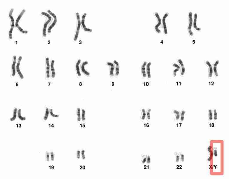 Nghiên cứu cho thấy nam giới hút thuốc lá sẽ dẫn đến mất nhiễm sắc thể Y