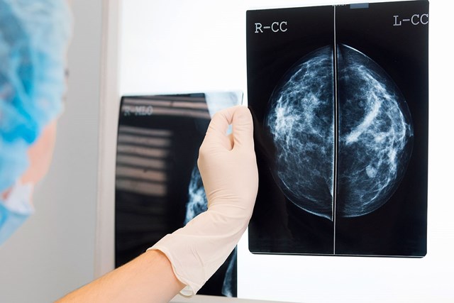 AI 'trợ lực' của bác sĩ trong phát hiện ung thư