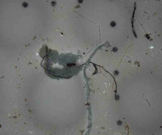 Vi nhựa lần đầu tiên được tìm thấy trong máu người, và nó có nguồn gốc từ nhu yếu phẩm hàng ngày! - Ảnh 4. Vi nhựa lần đầu tiên được tìm thấy trong máu người, và nó có nguồn gốc từ nhu yếu phẩm hàng ngày! - Ảnh 4.