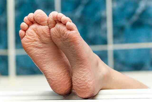 Tại sao ngón tay lại nhăn nheo sau khi tắm hoặc bơi lâu? - Ảnh 2.