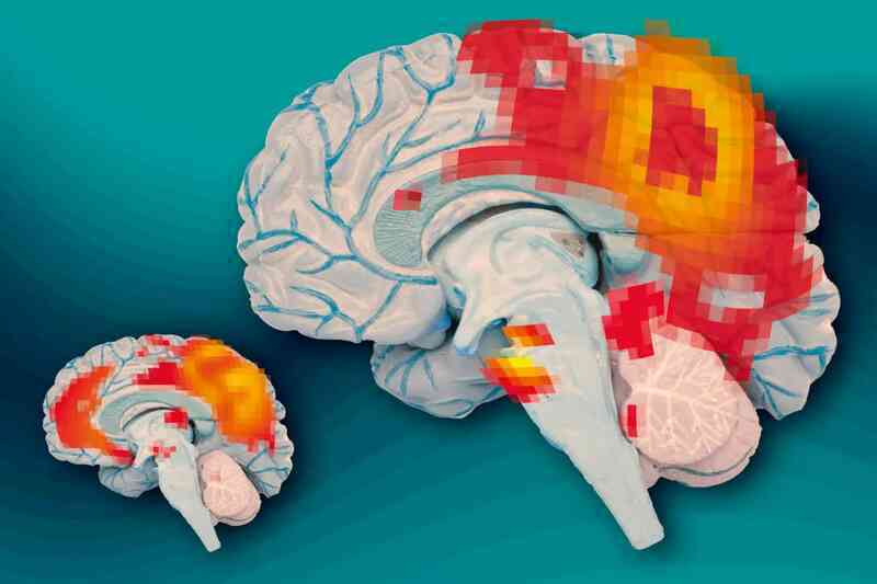 6 câu hỏi lớn nhất về ADHD ở người lớn!- Ảnh 2. 6 câu hỏi lớn nhất về ADHD ở người lớn!- Ảnh 2.
