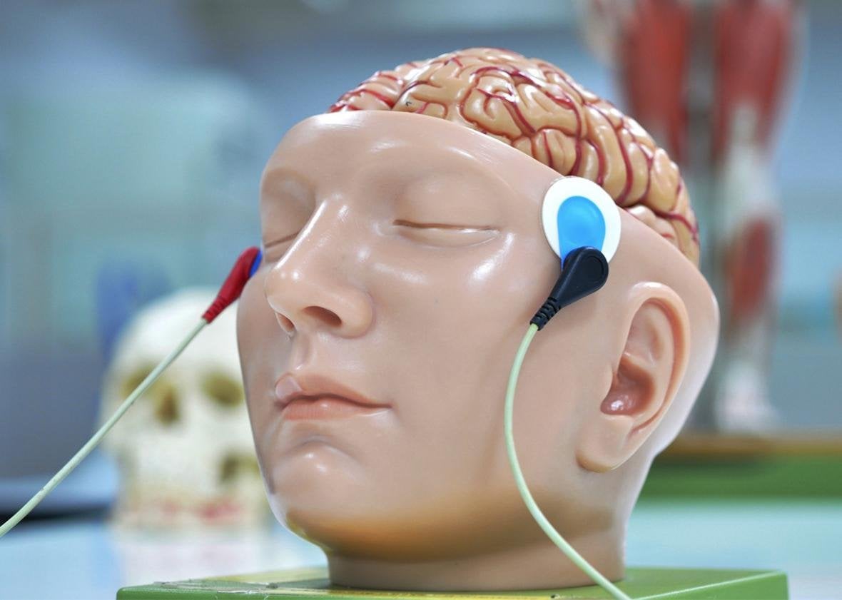 Các nhà khoa học tìm ra lý do tại sao những người bị tâm thần phân liệt luôn nghe thấy giọng nói bí ẩn bên tai- Ảnh 5. Các nhà khoa học tìm ra lý do tại sao những người bị tâm thần phân liệt luôn nghe thấy giọng nói bí ẩn bên tai- Ảnh 5.
