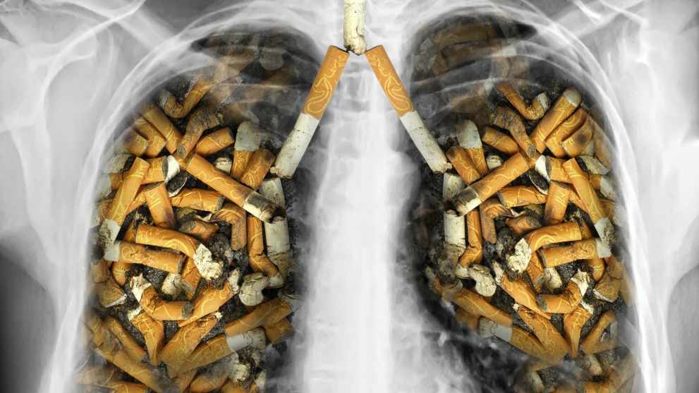Cấm bán thuốc lá cho thế hệ 2K có thể cứu sống 1,2 triệu người, tiết kiệm được 120 nghìn tỷ tiền mua thuốc ung thư phổi- Ảnh 3. Cấm bán thuốc lá cho thế hệ 2K có thể cứu sống 1,2 triệu người, tiết kiệm được 120 nghìn tỷ tiền mua thuốc ung thư phổi- Ảnh 3.