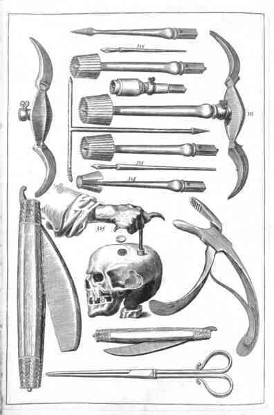 Trepanation: Thủ tục phẫu thuật sọ lâu đời nhất thế giới vẫn tồn tại đến ngày nay!- Ảnh 6. Trepanation: Thủ tục phẫu thuật sọ lâu đời nhất thế giới vẫn tồn tại đến ngày nay!- Ảnh 6.