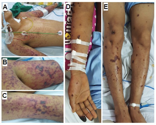Từ vụ sinh viên Bách Khoa ăn cơm canh thừa: Khuyến cáo về một căn bệnh cực kỳ nguy hiểm, có khả năng lây chéo- Ảnh 4. Từ vụ sinh viên Bách Khoa ăn cơm canh thừa: Khuyến cáo về một căn bệnh cực kỳ nguy hiểm, có khả năng lây chéo- Ảnh 4.