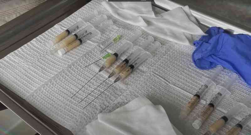 Bị chê mặt già hốc hác, triệu phú 47 tuổi tiêm mỡ lên mặt để trẻ lại tuổi 18 và cái kết không còn ai nhận ra- Ảnh 11. Bị chê mặt già hốc hác, triệu phú 47 tuổi tiêm mỡ lên mặt để trẻ lại tuổi 18 và cái kết không còn ai nhận ra- Ảnh 11.