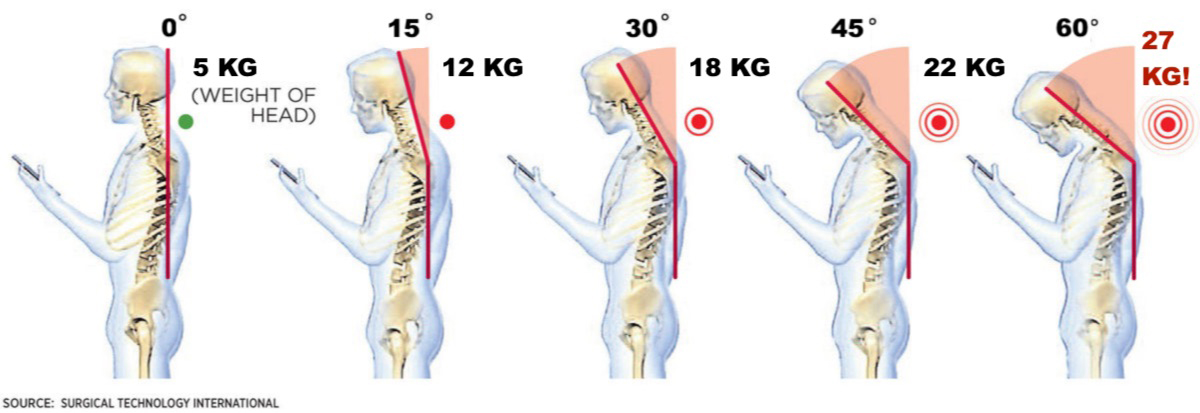 Khi bạn ốm, mẹ bạn bảo đó là do bạn chơi điện thoại quá nhiều: Liệu điều đó có đúng?- Ảnh 4. Khi bạn ốm, mẹ bạn bảo đó là do bạn chơi điện thoại quá nhiều: Liệu điều đó có đúng?- Ảnh 4.