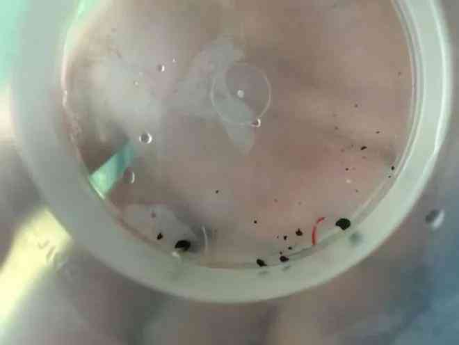 Đỉa có thể tồn tại trong mũi hơn nửa tháng, tại sao sức sống của chúng lại ngoan cường như vậy?- Ảnh 2. Đỉa có thể tồn tại trong mũi hơn nửa tháng, tại sao sức sống của chúng lại ngoan cường như vậy?- Ảnh 2.