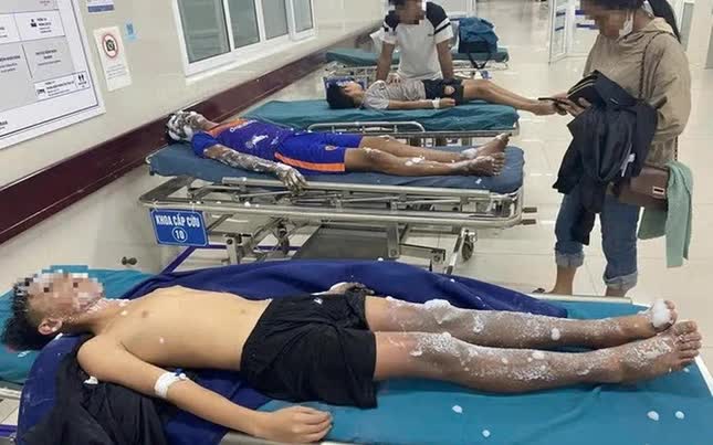 4 học sinh bị bỏng nặng do tự chế pháo nổ theo Youtube