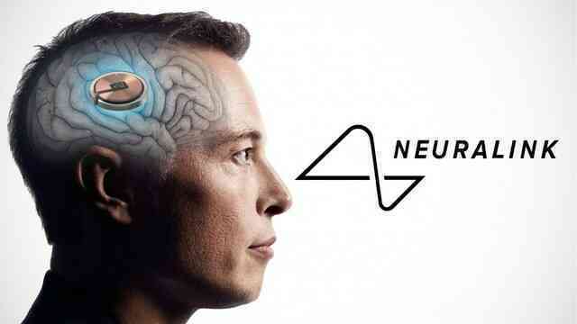 Người đầu tiên được cấy chip não Neuralink đã hồi phục, còn được bổ sung thêm "siêu năng lực" mới