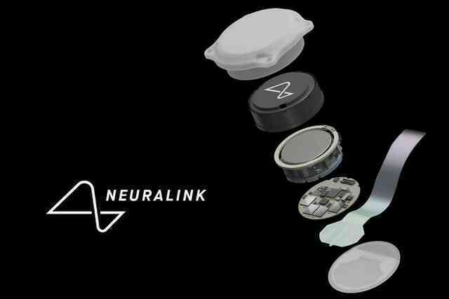 Người đầu tiên được cấy chip não Neuralink đã hồi phục, còn được bổ sung thêm Người đầu tiên được cấy chip não Neuralink đã hồi phục, còn được bổ sung thêm