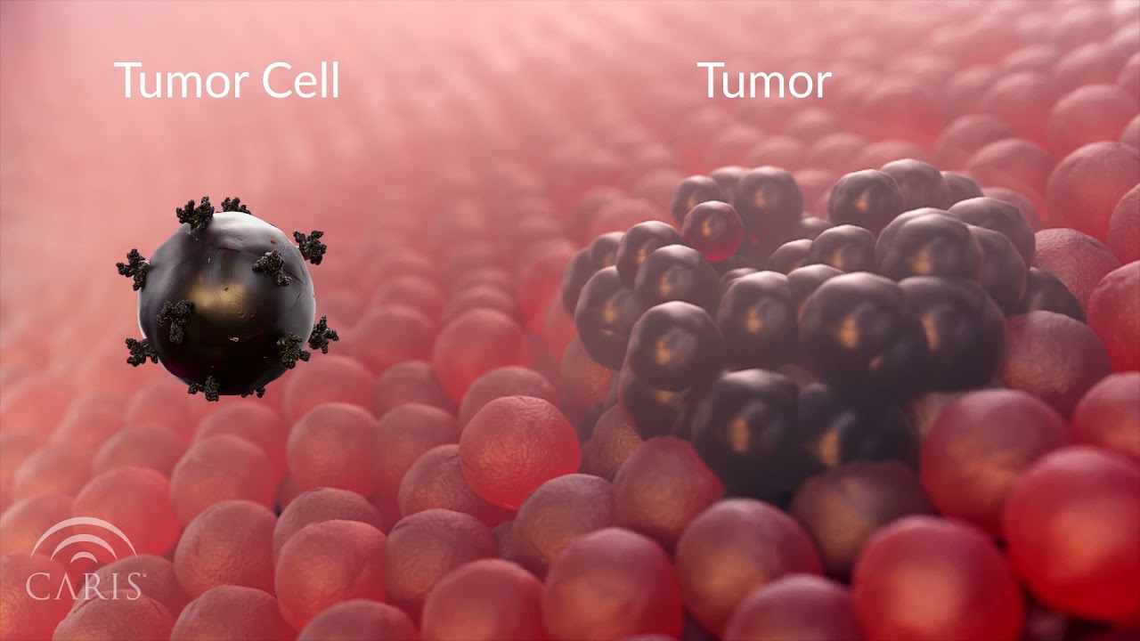 Thuốc CAR-T, hơn 10 tỷ VNĐ/liều, chữa khỏi ung thư nhưng cũng có thể khiến bệnh nhân mắc thêm bệnh ung thư mới- Ảnh 3.