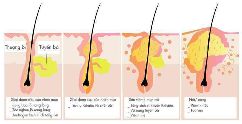 Nhà khoa học này muốn bắt vi khuẩn trên mặt bạn, biến đổi gen chúng rồi thả về chỗ cũ: Thoạt nghe tưởng cô ấy bị rảnh, nhưng hiểu lý do thì ai cũng trầm trồ- Ảnh 8. Nhà khoa học này muốn bắt vi khuẩn trên mặt bạn, biến đổi gen chúng rồi thả về chỗ cũ: Thoạt nghe tưởng cô ấy bị rảnh, nhưng hiểu lý do thì ai cũng trầm trồ- Ảnh 8.