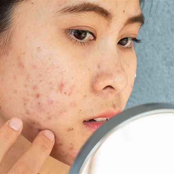Nhà khoa học này muốn bắt vi khuẩn trên mặt bạn, biến đổi gen chúng rồi thả về chỗ cũ: Thoạt nghe tưởng cô ấy bị rảnh, nhưng hiểu lý do thì ai cũng trầm trồ- Ảnh 9. Nhà khoa học này muốn bắt vi khuẩn trên mặt bạn, biến đổi gen chúng rồi thả về chỗ cũ: Thoạt nghe tưởng cô ấy bị rảnh, nhưng hiểu lý do thì ai cũng trầm trồ- Ảnh 9.