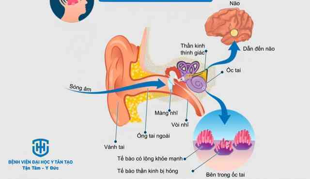 Tết hát karaoke quá 1 tiếng/ngày có thể khiến cả nhà bị tòe lông ốc tai, hiện chưa có thuốc chữa