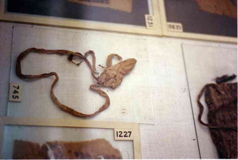Đây là 5 công cụ tránh thai của 100 năm trước, giờ chỉ còn thấy trong viện bảo tàng- Ảnh 2.