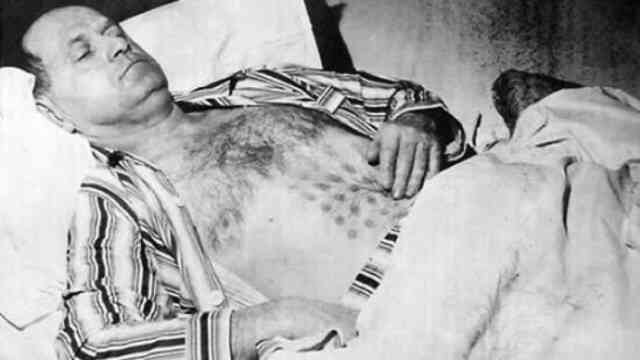 Sự kiện UFO hồ Falcon: Người đàn ông bị bỏng sau khi chạm vào UFO và dấu vết trên cơ thể không mờ đi suốt 32 năm!- Ảnh 6.