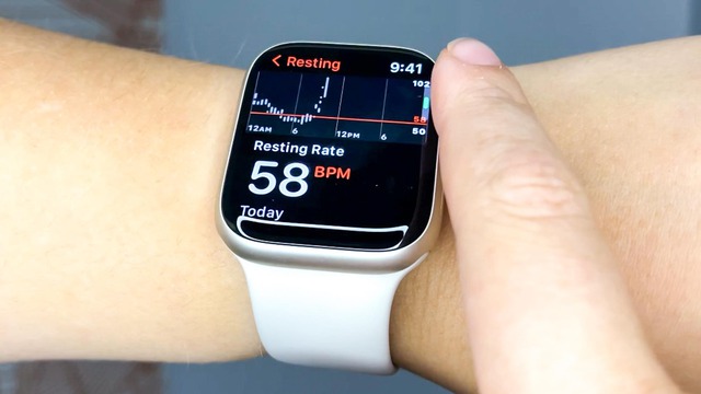 Người dùng Apple Watch sắp được trải nghiệm tính năng mà Samsung trang bị cho Galaxy Watch từ lâu
