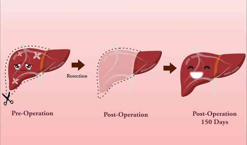 Sau mỗi bữa nhậu, một phần lá gan của bạn sẽ chết: Gan mới sẽ mọc ra sau 5 tiếng, nhưng hậu quả lâu dài mới là thứ thực sự đáng sợ- Ảnh 2. Sau mỗi bữa nhậu, một phần lá gan của bạn sẽ chết: Gan mới sẽ mọc ra sau 5 tiếng, nhưng hậu quả lâu dài mới là thứ thực sự đáng sợ- Ảnh 2.