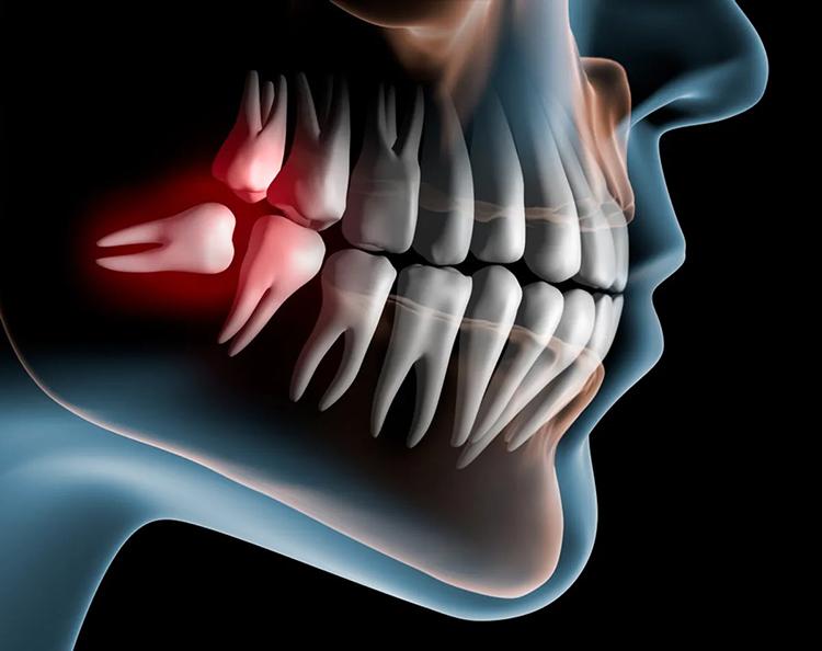 Không hề đánh răng hay chăm sóc răng miệng, vì sao răng người tiền sử lại thẳng và đều đến vậy?
