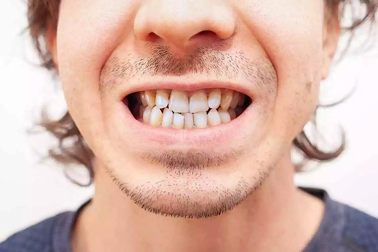 Không hề đánh răng hay chăm sóc răng miệng, vì sao răng người tiền sử lại thẳng và đều đến vậy?- Ảnh 2. Không hề đánh răng hay chăm sóc răng miệng, vì sao răng người tiền sử lại thẳng và đều đến vậy?- Ảnh 2.