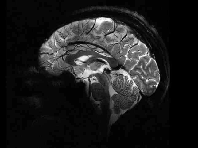 Hình ảnh rõ nét nhất về bộ não chúng ta từ siêu máy quét MRI