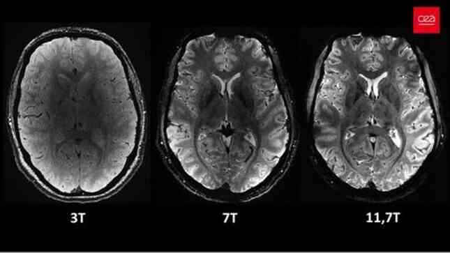 Hình ảnh rõ nét nhất về bộ não chúng ta từ siêu máy quét MRI- Ảnh 2. Hình ảnh rõ nét nhất về bộ não chúng ta từ siêu máy quét MRI- Ảnh 2.