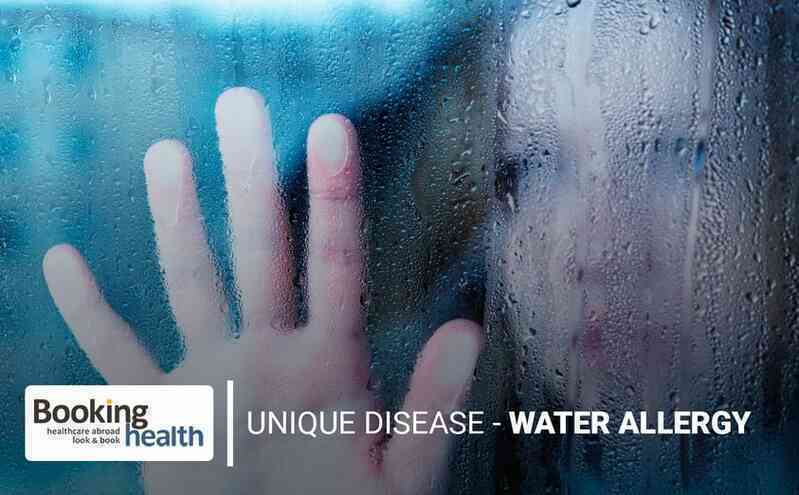 Không tắm, không rửa tay, không đổ mồ hôi và không được khóc: Cuộc sống của những bệnh nhân dị ứng với nước