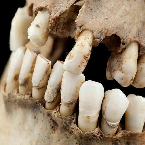 Người ta làm sạch răng như thế nào trước khi kem đánh răng được phát minh?