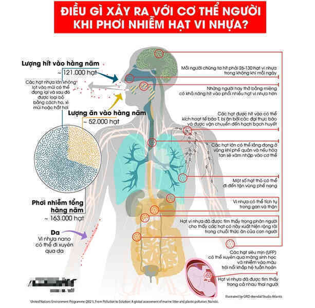Khi cá ngoài biển vướng phải túi nilon, trong cơ thể người, tinh trùng cũng đang bơi cạnh hạt vi nhựa- Ảnh 5. Khi cá ngoài biển vướng phải túi nilon, trong cơ thể người, tinh trùng cũng đang bơi cạnh hạt vi nhựa- Ảnh 5.