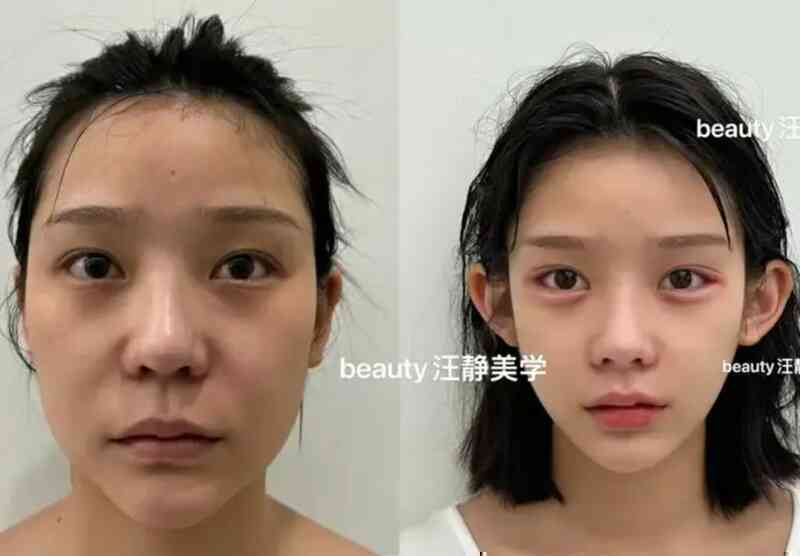 Hơn 500 cô gái ở Trung Quốc có gương mặt giống hệt nhau, nguyên nhân là gì?