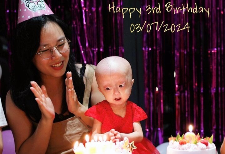 Cuộc sống hiện tại của bé gái mắc chứng 'vừa chào đời đã già'