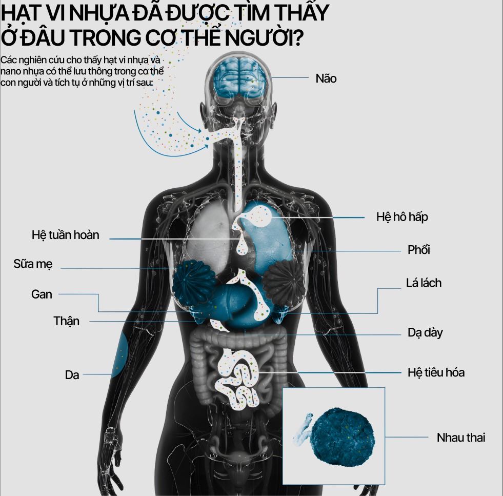 Đúng 20 năm về trước, hạt vi nhựa đầu tiên được phát hiện, hơn 7.000 nghiên cứu đã được thực hiện kể từ đó, kết quả chỉ ra điều gì?- Ảnh 5. Đúng 20 năm về trước, hạt vi nhựa đầu tiên được phát hiện, hơn 7.000 nghiên cứu đã được thực hiện kể từ đó, kết quả chỉ ra điều gì?- Ảnh 5.