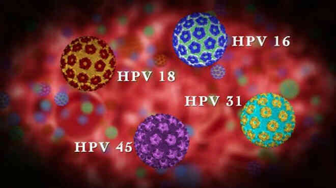 Người đàn ông bất ngờ phát hiện mắc ung thư ở miệng, vì chủng virus anh nghĩ chỉ lây nhiễm tử cung phụ nữ- Ảnh 4. Người đàn ông bất ngờ phát hiện mắc ung thư ở miệng, vì chủng virus anh nghĩ chỉ lây nhiễm tử cung phụ nữ- Ảnh 4.