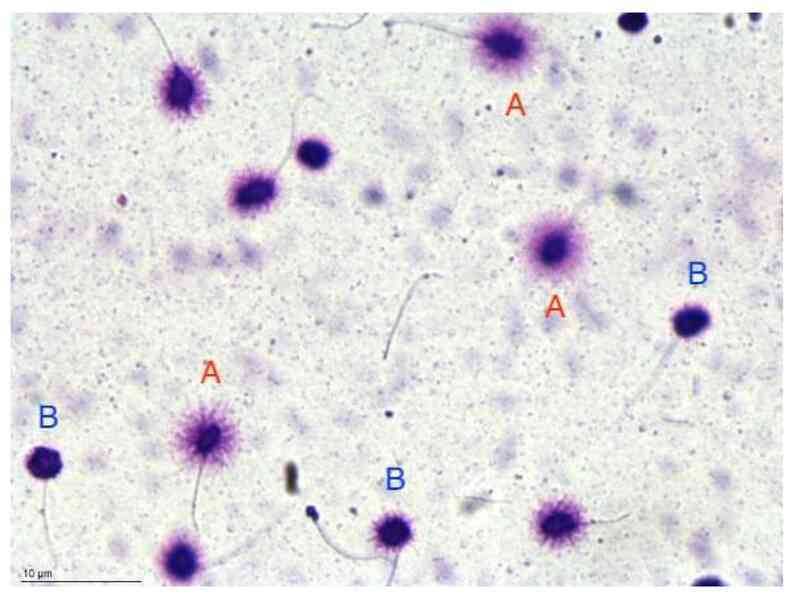 Người đàn ông bất ngờ phát hiện mắc ung thư ở miệng, vì chủng virus anh nghĩ chỉ lây nhiễm tử cung phụ nữ- Ảnh 8. Người đàn ông bất ngờ phát hiện mắc ung thư ở miệng, vì chủng virus anh nghĩ chỉ lây nhiễm tử cung phụ nữ- Ảnh 8.