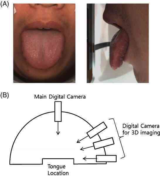 Cỗ máy có thể nhìn lưỡi đoán bệnh chính xác tới 98%: 1.500 năm phát triển của Đông y được gói vào trong một thuật toán AI duy nhất- Ảnh 12. Cỗ máy có thể nhìn lưỡi đoán bệnh chính xác tới 98%: 1.500 năm phát triển của Đông y được gói vào trong một thuật toán AI duy nhất- Ảnh 12.