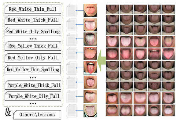 Cỗ máy có thể nhìn lưỡi đoán bệnh chính xác tới 98%: 1.500 năm phát triển của Đông y được gói vào trong một thuật toán AI duy nhất- Ảnh 13. Cỗ máy có thể nhìn lưỡi đoán bệnh chính xác tới 98%: 1.500 năm phát triển của Đông y được gói vào trong một thuật toán AI duy nhất- Ảnh 13.