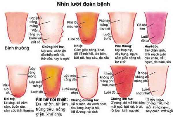 Cỗ máy có thể nhìn lưỡi đoán bệnh chính xác tới 98%: 1.500 năm phát triển của Đông y được gói vào trong một thuật toán AI duy nhất- Ảnh 3. Cỗ máy có thể nhìn lưỡi đoán bệnh chính xác tới 98%: 1.500 năm phát triển của Đông y được gói vào trong một thuật toán AI duy nhất- Ảnh 3.