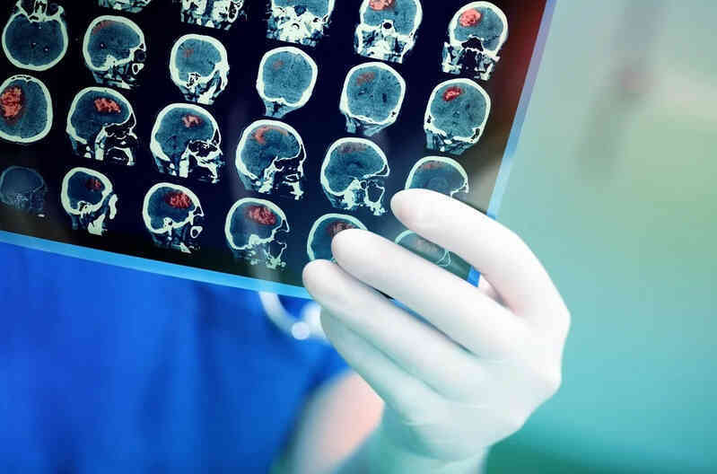 Sự bùng nổ của AI sẽ tạo ra đột phá cho chẩn đoán, điều trị ung thư
