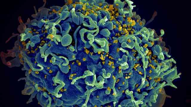 Giải mã gene chống HIV: Biến thể kháng virus có thể bắt nguồn từ người cổ đại sống gần Biển Đen cách đây 9.000 năm- Ảnh 4. Giải mã gene chống HIV: Biến thể kháng virus có thể bắt nguồn từ người cổ đại sống gần Biển Đen cách đây 9.000 năm- Ảnh 4.