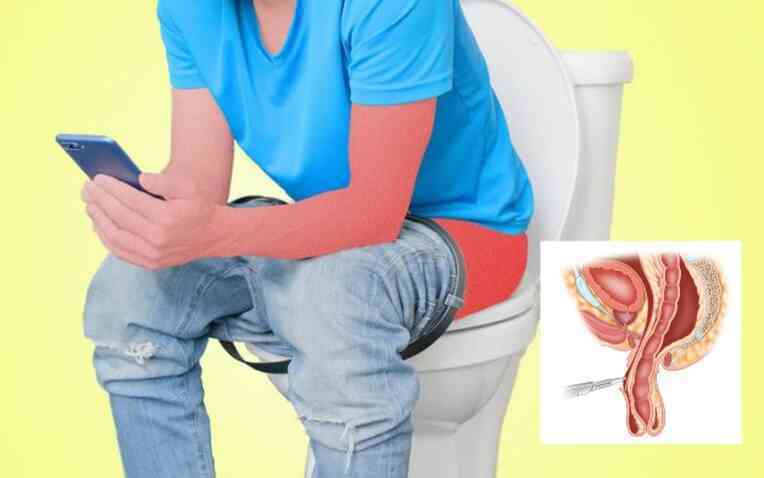 Sa 13 cm ruột ra ngoài vì ngồi toilet ôm điện thoại suốt 2 tiếng