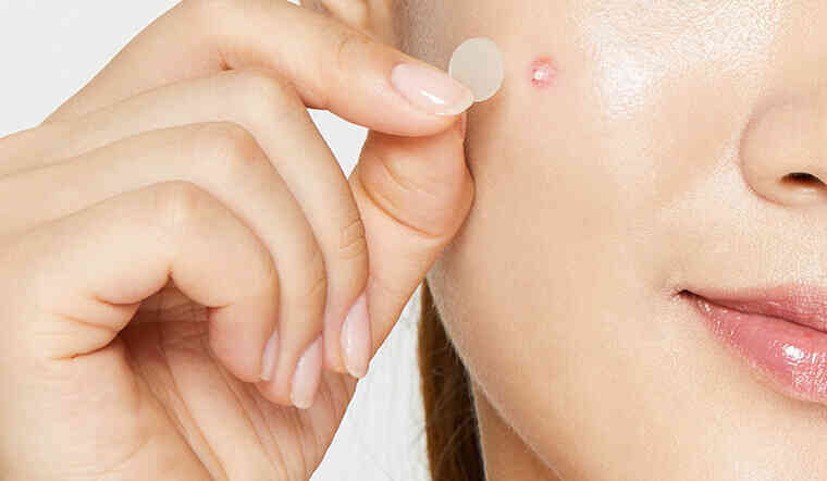 Nữ sinh 15 tuổi ở Hà Nội tử vong sau nặn mụn: Có một "tam giác tử thần" trên mặt mà bạn tuyệt đối không nên động vào- Ảnh 8. Nữ sinh 15 tuổi ở Hà Nội tử vong sau nặn mụn: Có một "tam giác tử thần" trên mặt mà bạn tuyệt đối không nên động vào- Ảnh 8.