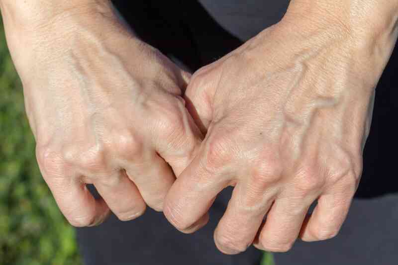 Nổi nhiều gân tay là khỏe hay yếu? Thấy gân xanh nổi rõ ở 6 nơi này trên cơ thể tức trong người đầy bệnh