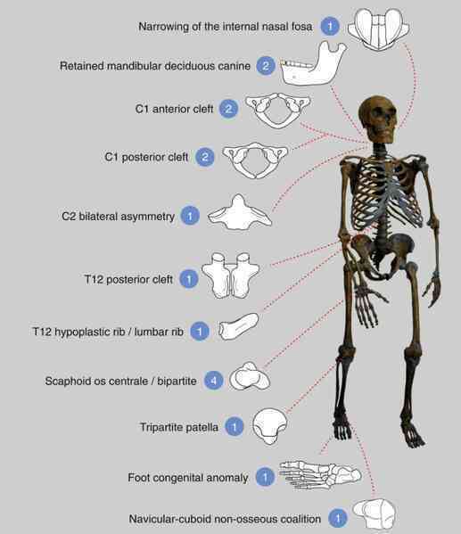 Bí ẩn 'lời nguyền' của người Neanderthal: Hóa thạch 30.000 năm tuổi hé lộ bi kịch tuyệt chủng đầy máu và nước mắt!- Ảnh 2.