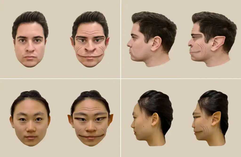 Căn bệnh lạ lùng khiến người phụ nữ này nhìn thấy ‘rồng’ thay vì khuôn mặt người